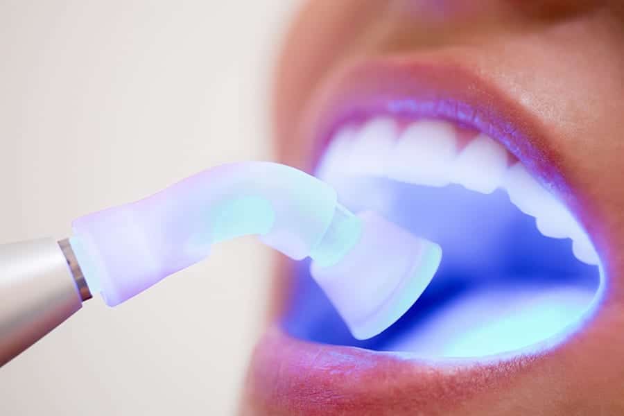 Female patient in deltal office receiving dental filling drying procedure.