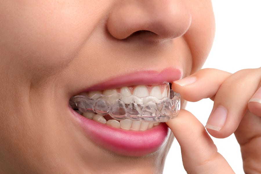 Woman wearing orthodontic silicone trainer. Invisible braces