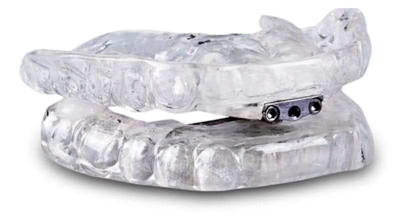 sleap-apnea-oral-appliance