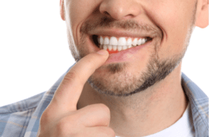 Man with gum inflammation closeup