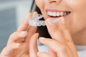 invisalign treatment