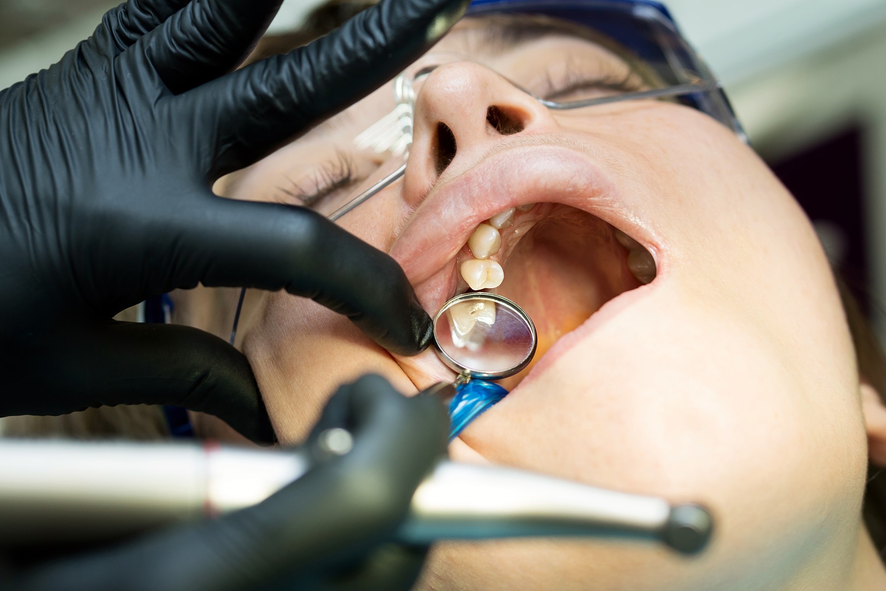 Woman getting a root canal treatment at the dentist in Goodlettsville, TN