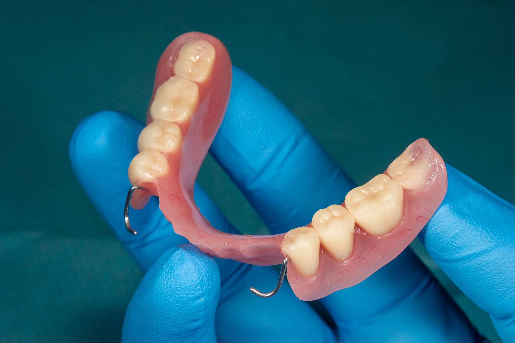 Partial dentures available at Schmitt Dental in Tennessee