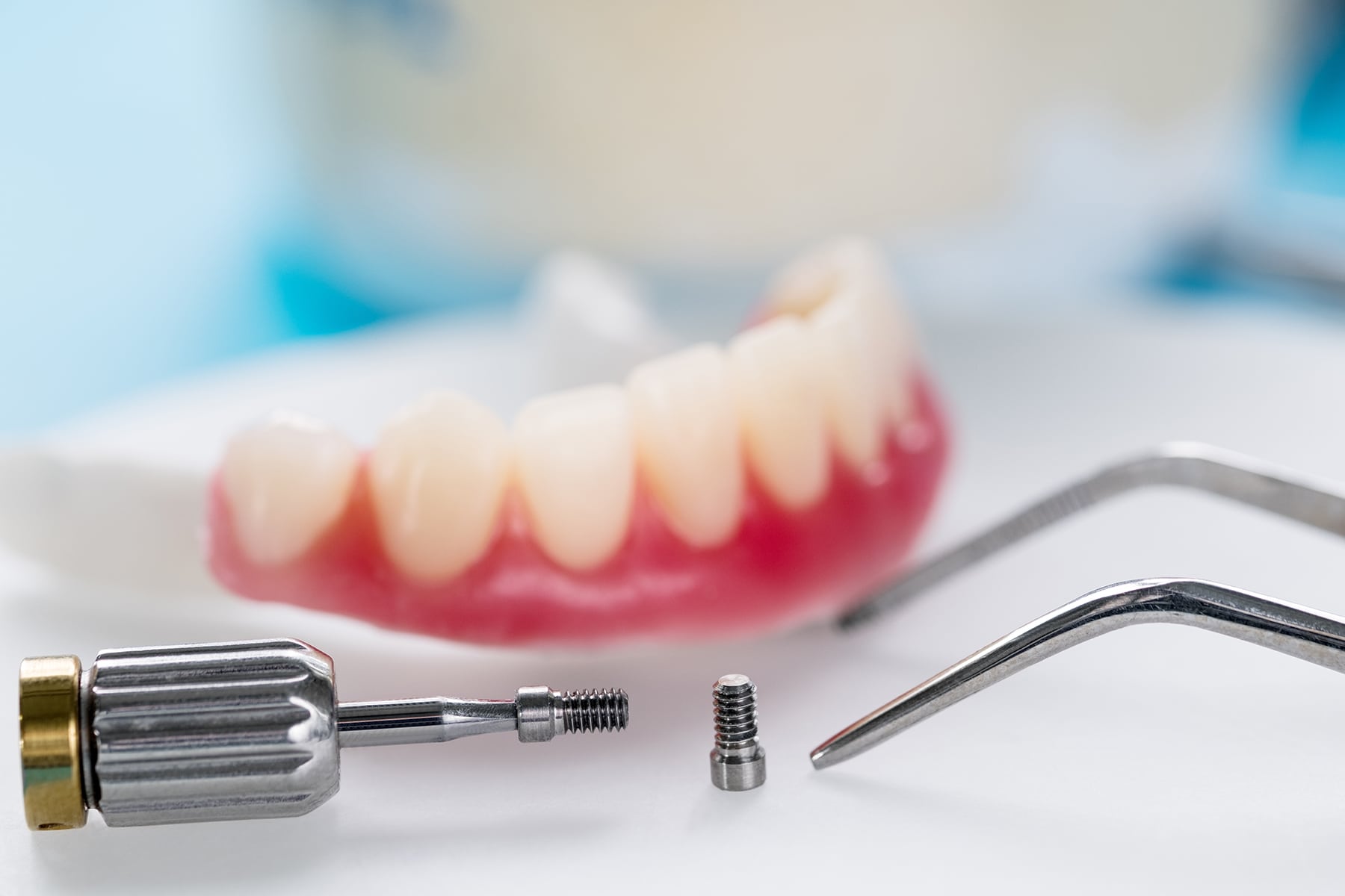 Implant dentures available at Schmitt Dental in Tennessee