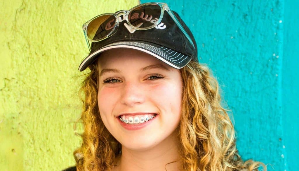 Summer Braces and Clear Aligners in Clarksville